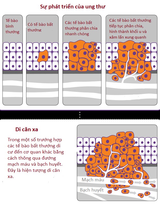 Tế bào ung thư là gì? Cách hình thành và tác động đến cơ thể